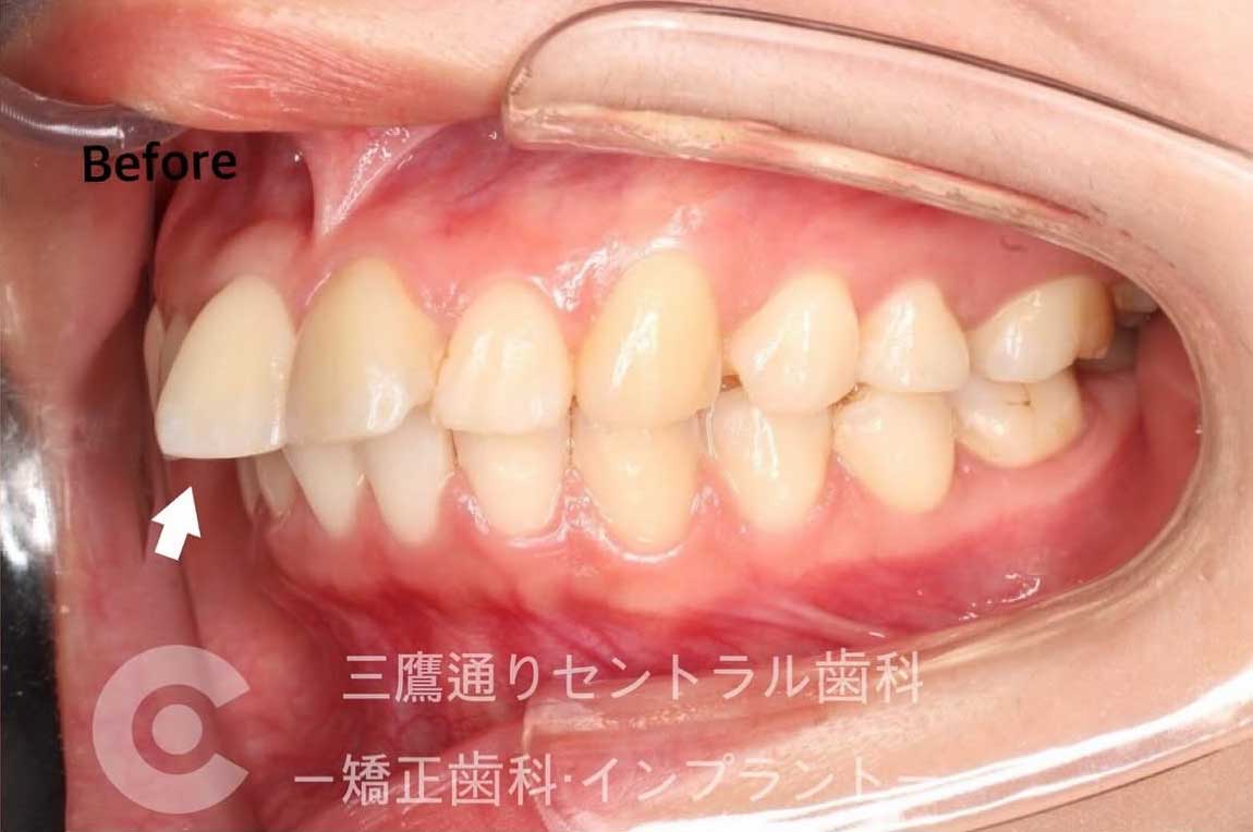 Before