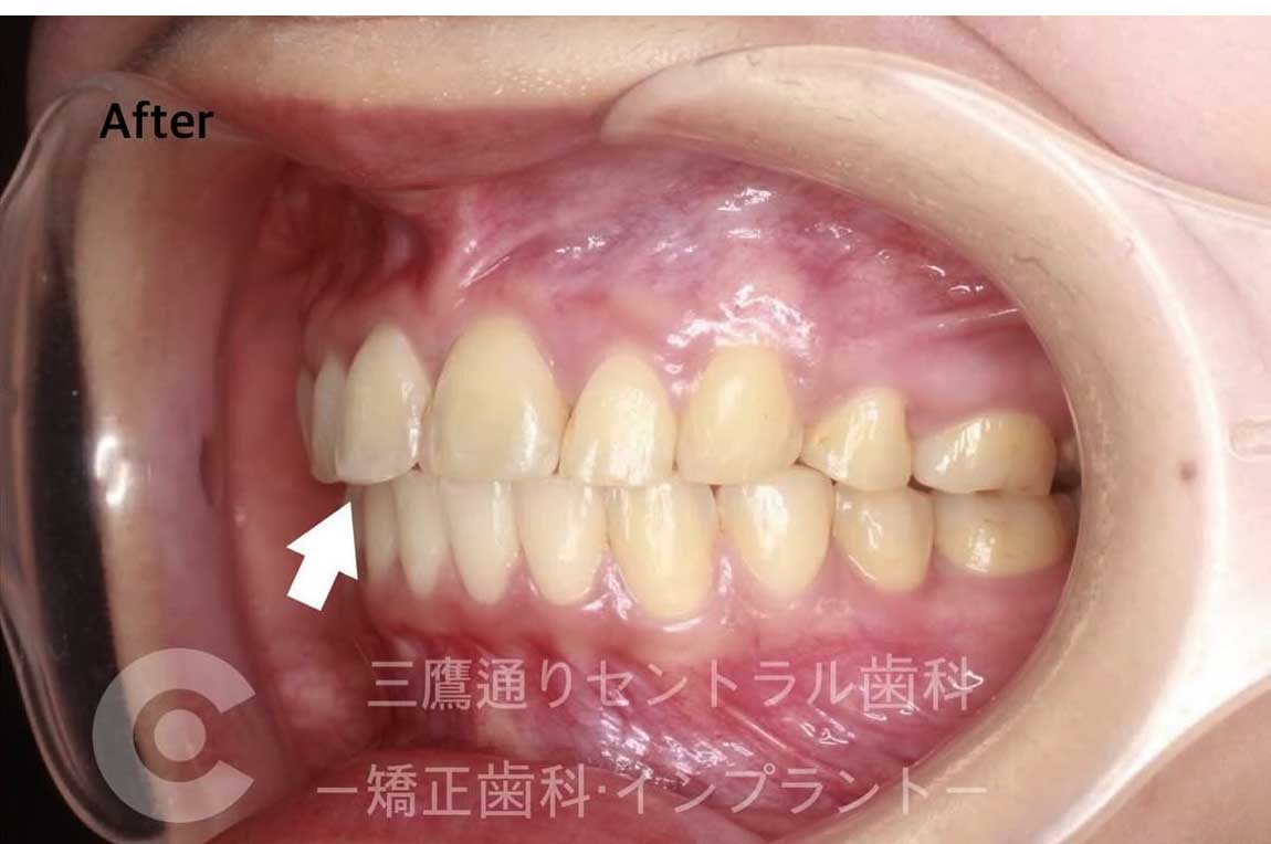 After