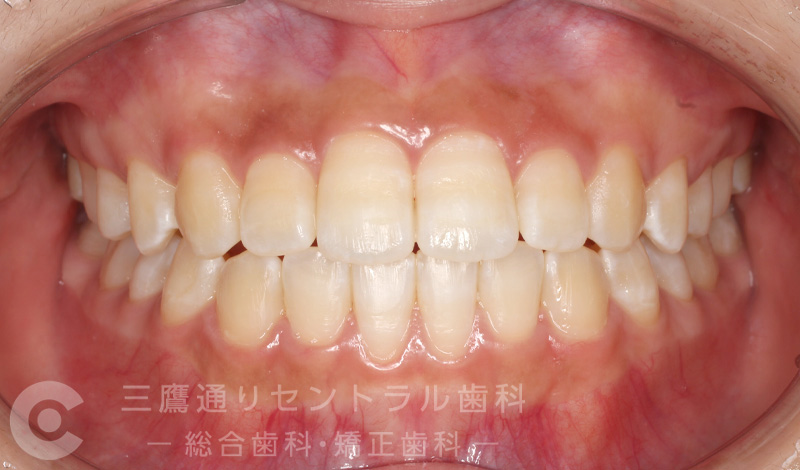 After