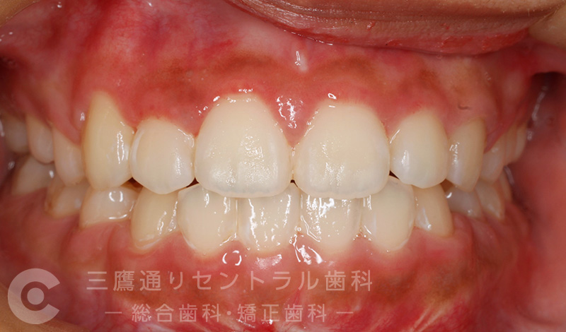 After