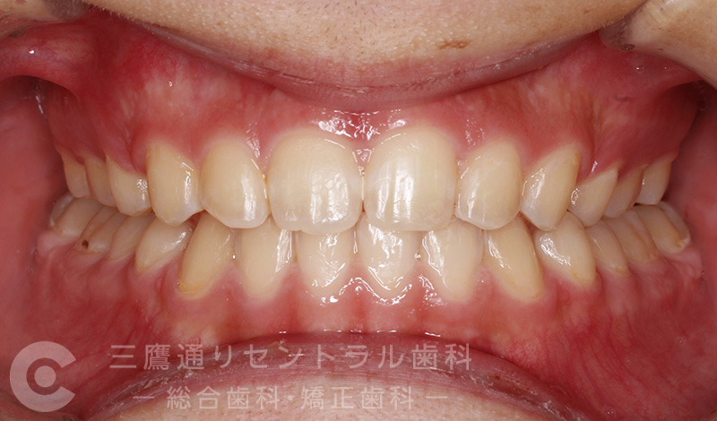 After