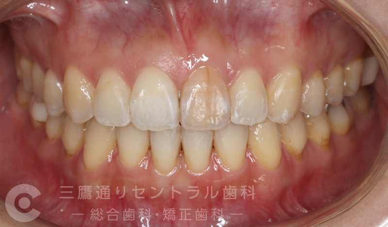 After