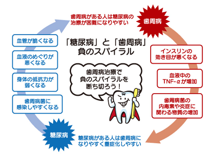 歯周病と糖尿病の関係